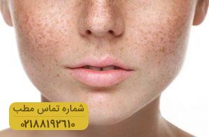 تشخیص سلامتی بدن از تظاهرات پوستی
