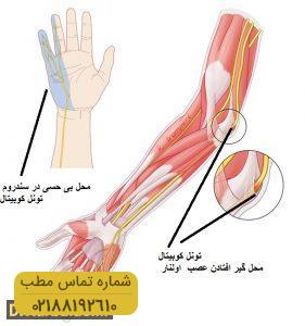 عصب اولنار و بیماری ها آن