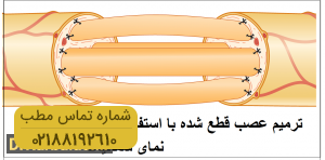 آناتومی و ساختمان شبکه بازویی