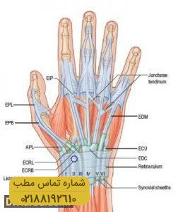 صدمات تاندون