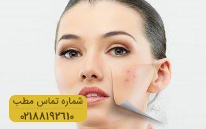 چگونه لکه های پوستی را درمان کنیم؟