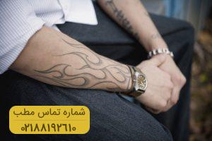 خالکوبی بعد از گذشت ۱۵ سال هم عفونت می کند