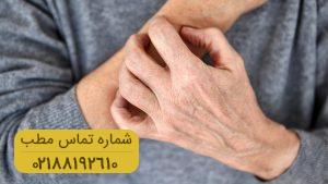 راهکارهای موثر خانگی برای درمان کهیر