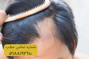 جلوگیری از کچل شدن با مصرف گوشت