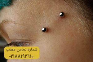 بررسی مهم ترین نکات در رابطه با عفونت زا بودن پیرسینگ