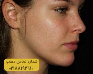 مراقبت از پوست با روش های موثر