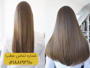 ۷ راهکار موثر برای خلاصی از ریزش مو