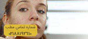 درمان کک و مک های پوستی