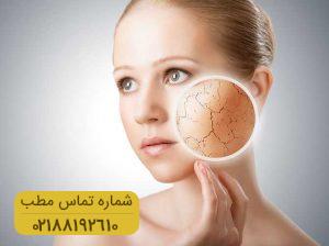 علت خشکی پوست چیست؟