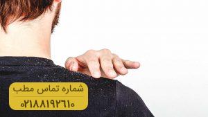 بهترین روش ها برای درمان خانگی شوره سر