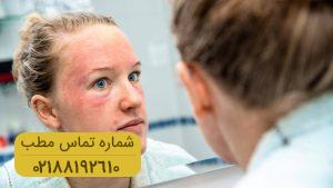 تمام اطلاعاتی که باید در مورد درمان اگزما پوست صورت بدانید