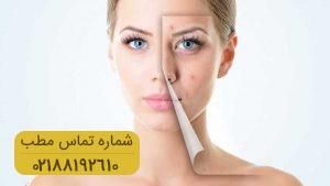 چگونه زخم های صورت خود را درمان کنیم؟