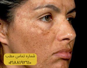 ۷ دلیل تغییر رنگ ناگهانی پوست