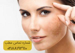 اطلاعاتی در خصوص لک پوستی