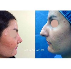 جراحی بینی در ونک و میرداماد
