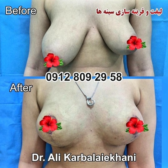 https://www.instagram.com/dr.karbalaeikhani/